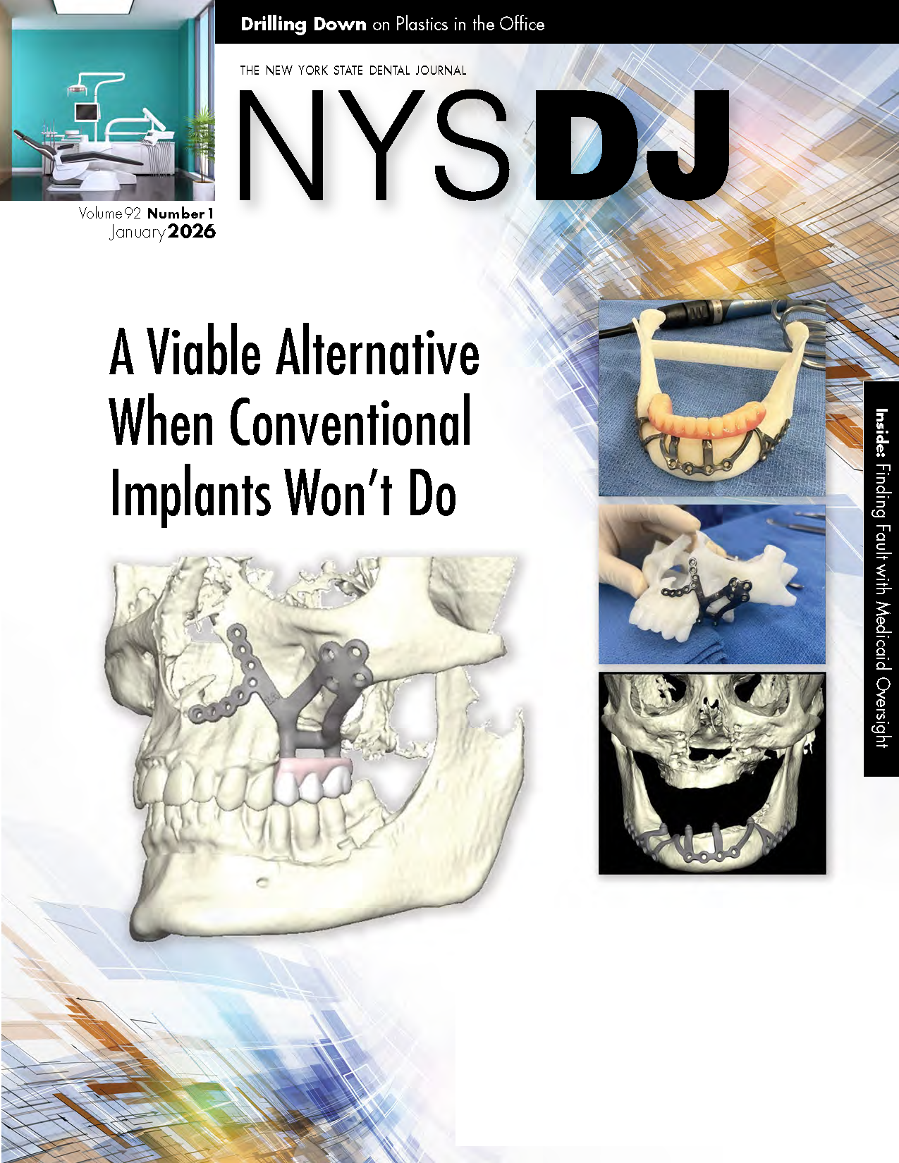Cover of the NYSDJ with 3D renders and photos of subperiosteal implant models