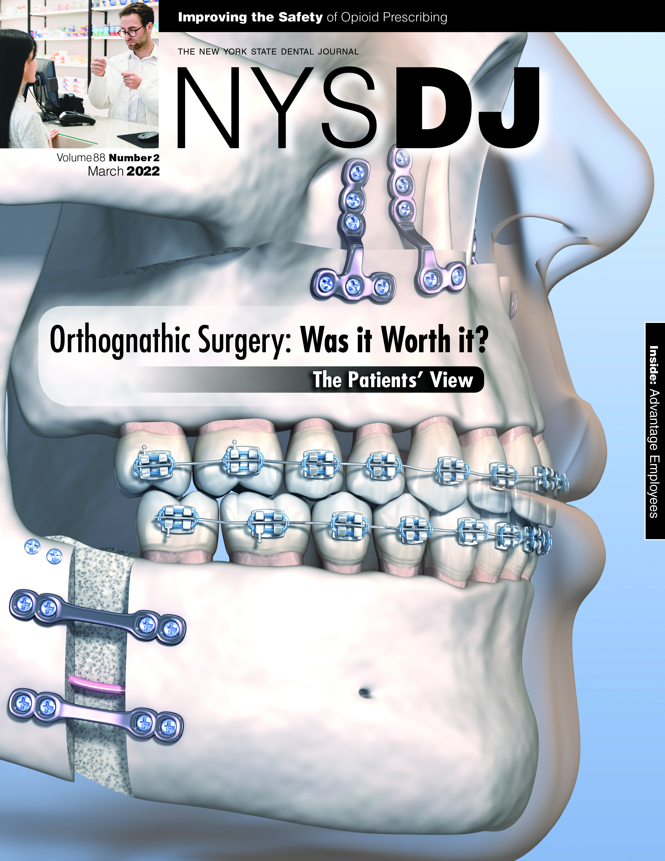 Cover of the NYSDJ with an illustration of a human skull post-orthognathic surgery.