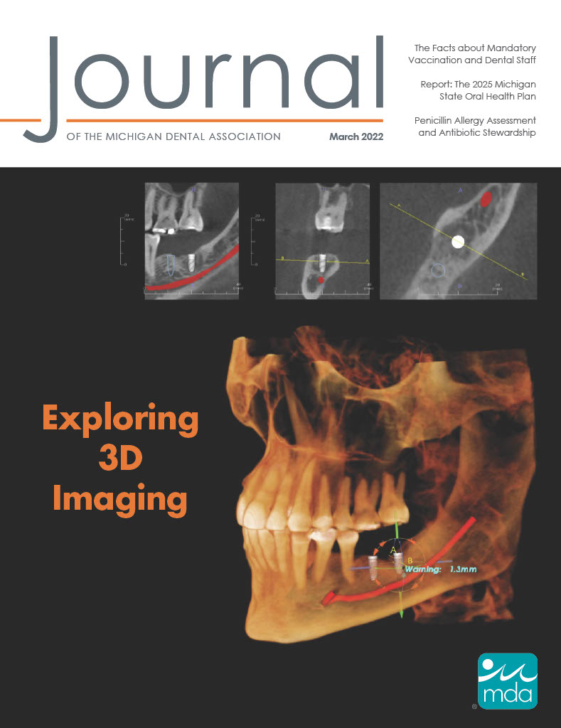 Cover of the Journal of the Michigan Dental Association featuring a CBCT scan identifying placement for two dental implants. There is one large skull and three smaller closeups from different angles above it.