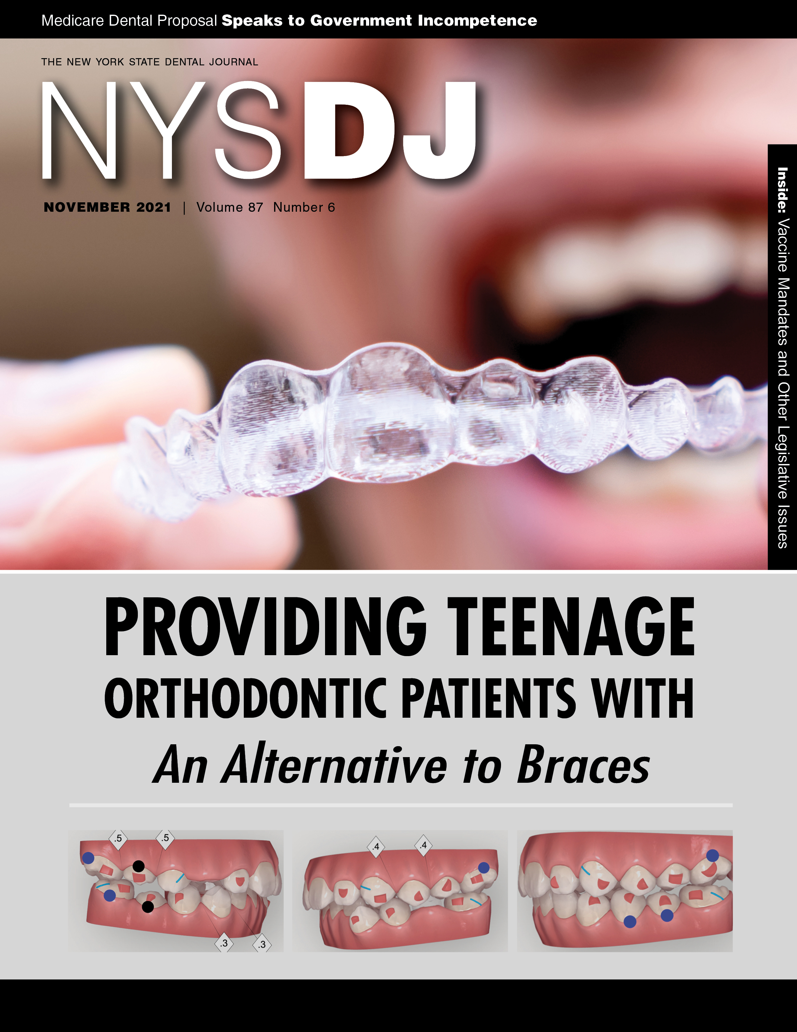 Cover of the NYSDJ with a photo of a person putting in their invisible aligner. Three orthodontic illustrations are below.