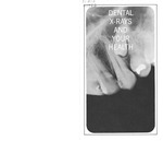 Dental X-Rays and Your Health (1966)