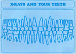 X-Rays and Your Teeth (1973) by American Dental Association